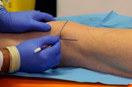 Terapia Infiltrativa ginocchio